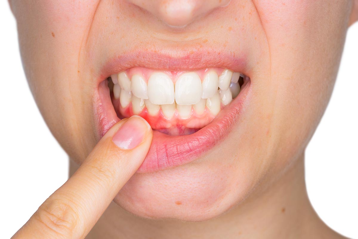 Can bone loss in teeth through gum disease be reversed