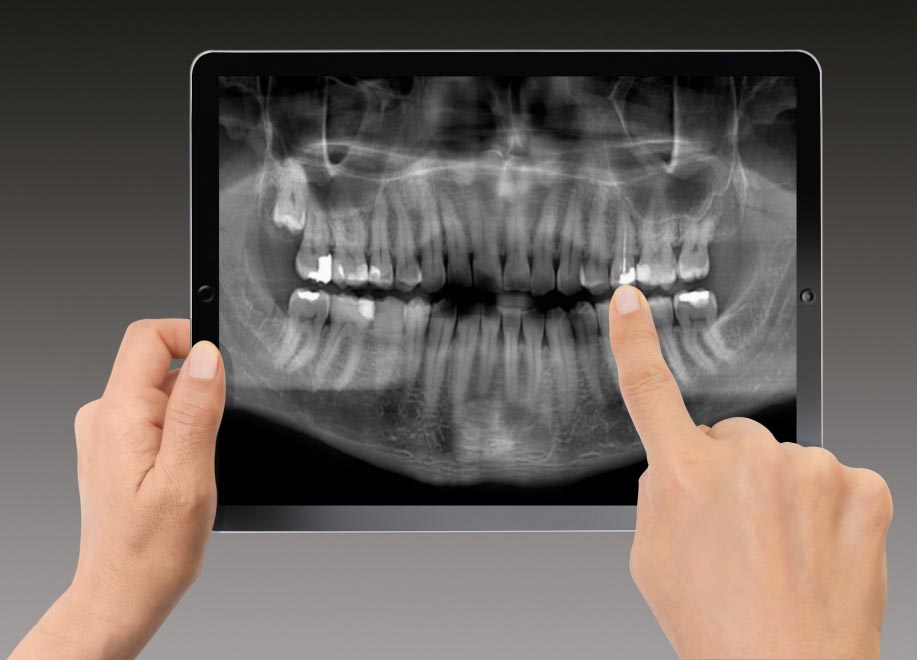 What are the advantages of digital x-rays