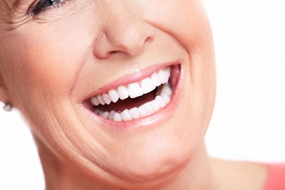 The Benefits of Implant-Supported Dentures for Surrey, BC Patients